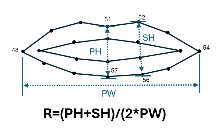 Diagram showing the definition of Mouth Aspect Ratio (MAR)