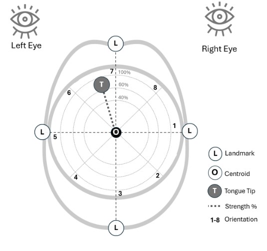 Design of the Tongue-Pad system